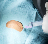 anaesthetic