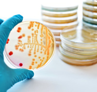 microbial
